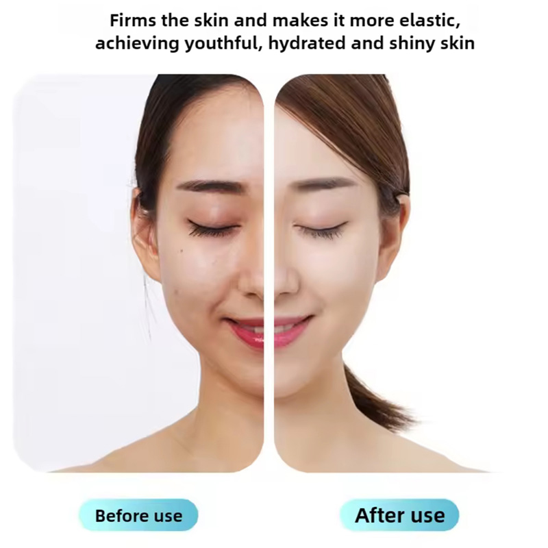 رول یخی جوانسازی و پاکسازی صورت